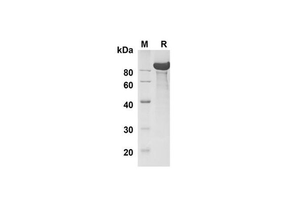 Recombinant Human DLL1 Protein (Fc Tag) (RPES8344)