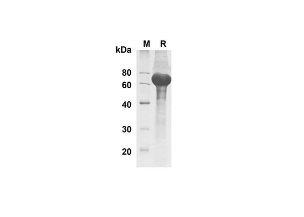 Recombinant Human DLL1 Protein (His Tag) (RPES8345)