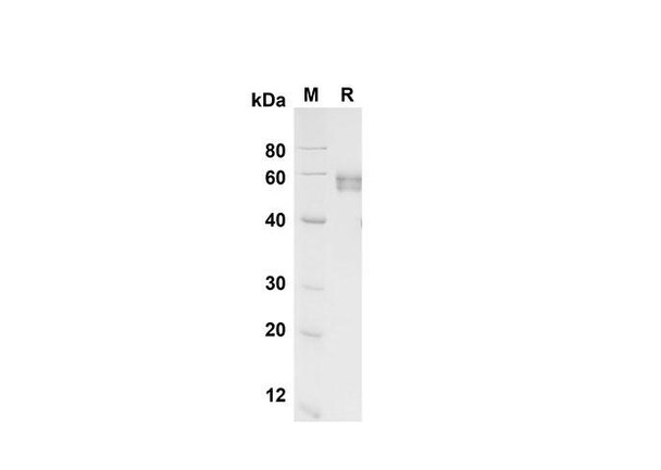 Recombinant Human EpCAM/TROP-1 Protein (Fc Tag) (RPES8356)