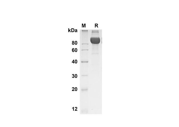 Recombinant Human BCAM Protein (Fc Tag) (RPES8349)