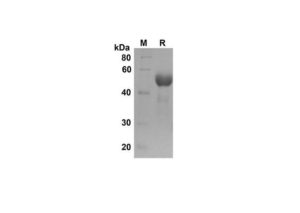 Recombinant Human FcÂ³ RIIB/CD32b Protein (Fc Tag) (RPES8358)