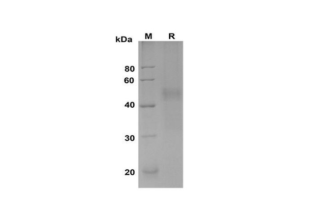 Recombinant Human PLAUR Protein (His Tag) (RPES8392)
