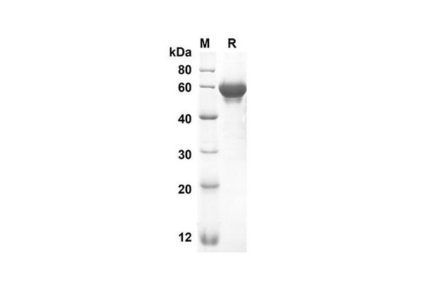 RecombinantÂ Mouse LBPÂ Protein (His tag) (RPES8393)