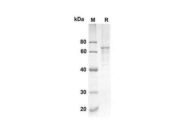 Recombinant Mouse CRTAM Protein (His Tag) (RPES8426)