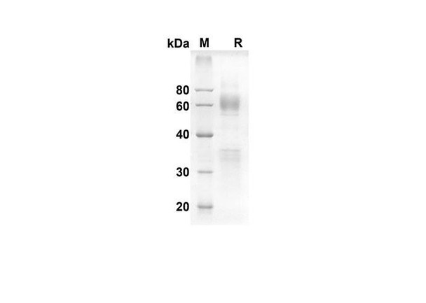 Recombinant Mouse Clusterin Protein (Fc Tag) (RPES8444)