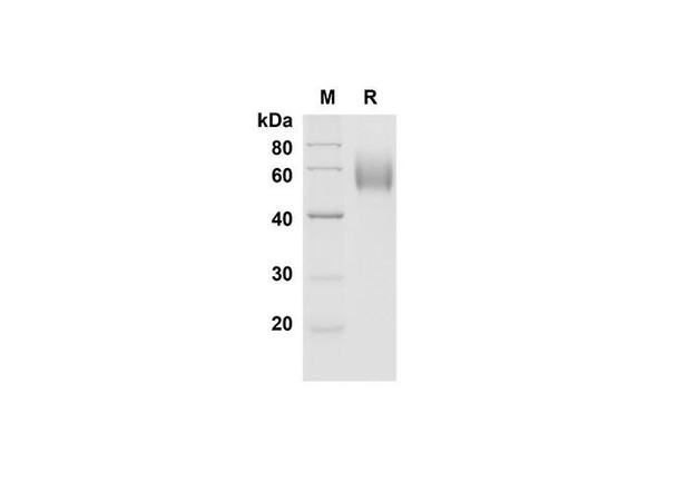Recombinant Mouse CD30 Ligand/TNFSF8 Protein (Fc Tag) (RPES8462)