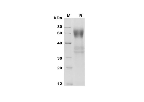 Recombinant Mouse IL-18 BPa Protein (Fc Tag) (RPES8481)