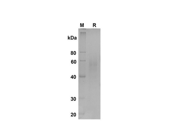 Recombinant Mouse Fas Ligand/TNFSF6 Protein (Fc Tag) (RPES8483)