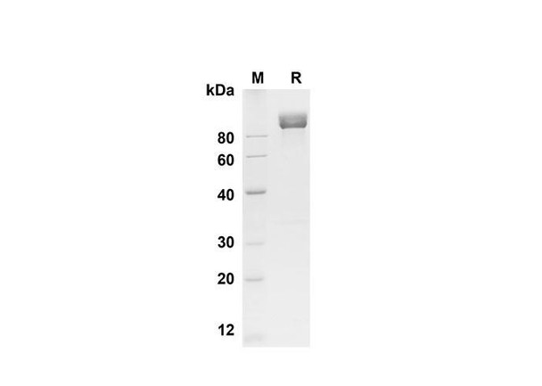 Recombinant Mouse CD117/c-kit Protein (Fc Tag) (RPES8487)