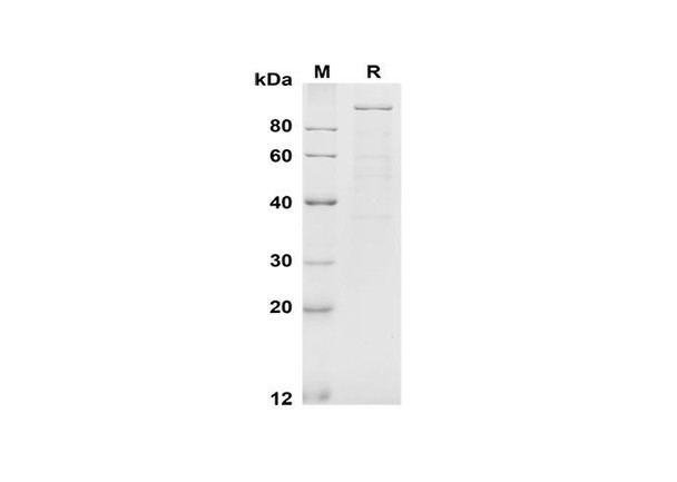 Recombinant Mouse E-Cadherin Protein (Fc Tag) (RPES8508)
