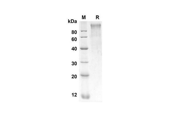 Recombinant Rat SELP Protein (His Tag) (RPES8516)