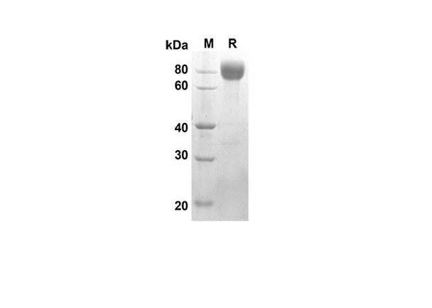Recombinant Rat CD62L/L-Selectin Protein (Fc Tag) (RPES8519)