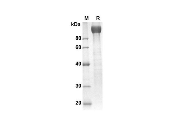 Recombinant Rat gp130 Protein (Fc Tag) (RPES8524)