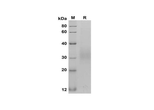 Recombinant Rat Fas/TNFRSF6/CD95 Protein (His Tag) (RPES8540)