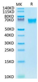 Biotinylated Recombinant Human Tyrosine-protein kinase receptor UFO/Axl Protein (RPCB0048)