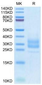 Recombinant Monkeypox virus M1R Protein (RPCB0125)