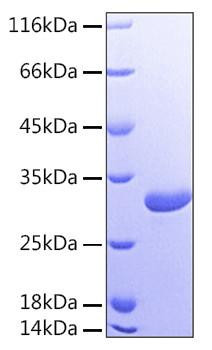 Recombinant Human Galectin-3/LGALS3 Protein (RPCB0151)