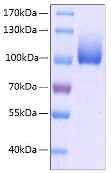 Recombinant Human LIMP II/SCARB2/CD36L2 Protein (RPCB0185)