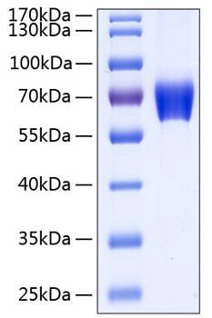 Recombinant Human Basigin/EMMPRIN/CD147 Protein (RPCB0259)