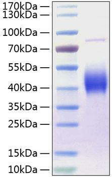 Recombinant Human B7-1/CD80 Protein (RPCB0269)