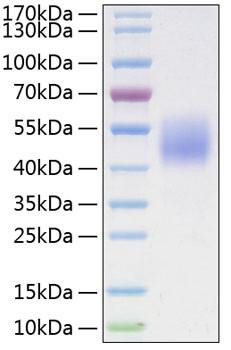 Recombinant Human B7-H4/VTCN1 Protein (RPCB0272)