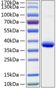 Recombinant Human IGFBP-2 Protein (RPCB0282)