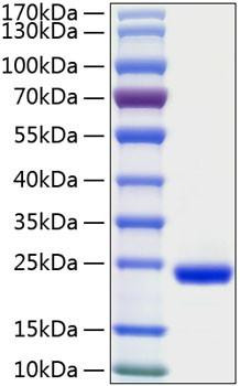 Recombinant Human IFN-lambda 2/IL-28A Protein (RPCB0306)