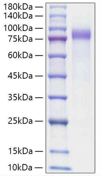 Recombinant Human Progranulin/PGRN/GRN Protein (RPCB0305)