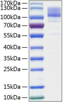 Recombinant Human ITGB1/CD29 Protein (RPCB0342)