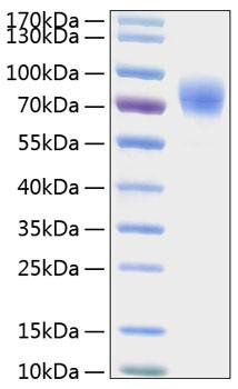 Recombinant Human Thrombopoietin/THPO Protein (RPCB0396)