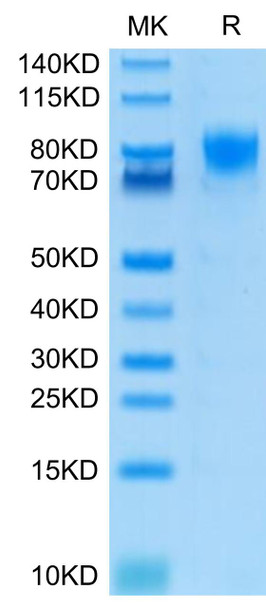 Recombinant Human DNAM-1/CD226 Protein (RPCB0442)