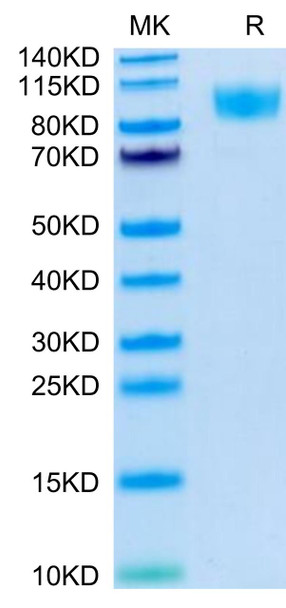 Biotinylated Recombinant Human PTPRC/CD45R0/CD45 Protein (RPCB0461)