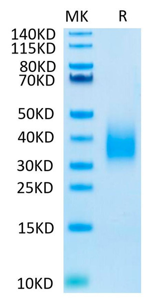 Biotinylated Recombinant Human TREM2 Protein (RPCB0503)