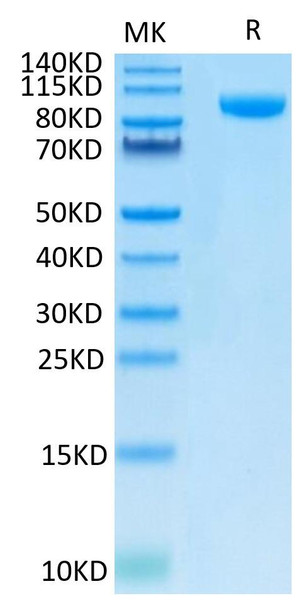 Recombinant Human B7-H3 (4Ig)/B7-H3b/CD276 Protein (RPCB0615)
