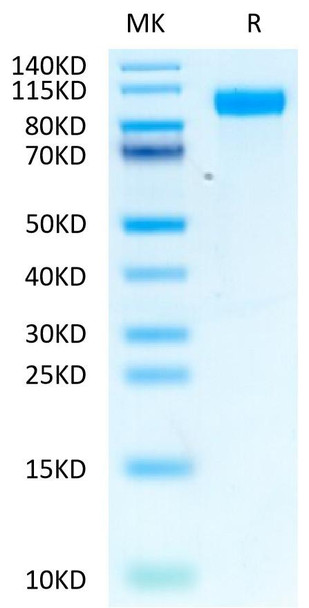 Biotinylated Recombinant Human ERBB1/HER1/EGFR Protein (RPCB0628)