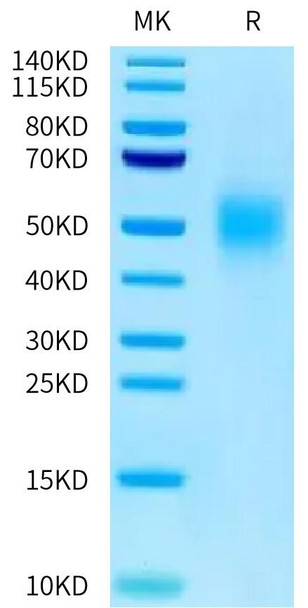 Recombinant Human CEACAM5/CEA/CD66e (323-500) Protein (RPCB0643)