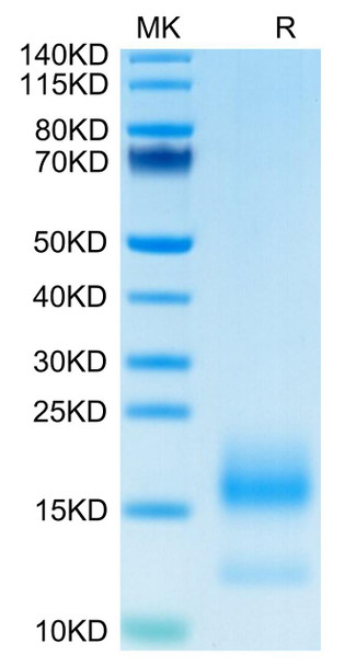 Recombinant Human TNFRSF17/BCMA/CD269 Protein (RPCB0657)
