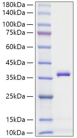 Recombinant Mouse Apolipoprotein E/APOE Protein (RPCB0665)