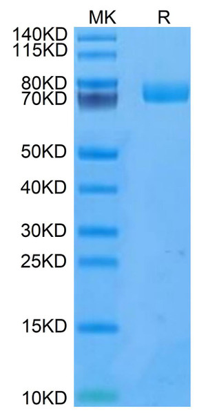 Recombinant Human uPAR/PLAUR/CD87 Protein (RPCB0740)
