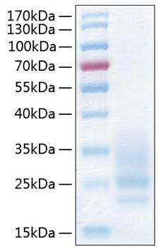 Recombinant Human CD83 Protein (RPCB0745)