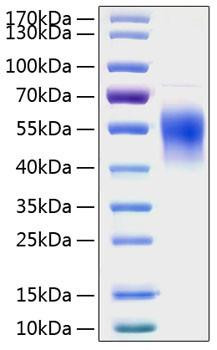 Recombinant Human IL-2RG/CD132 Protein (RPCB0807)