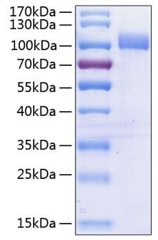 Recombinant Human VCAM-1/CD106 Protein (RPCB0835)