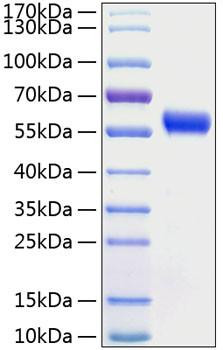 Recombinant Human Frizzled-5/FZD5 Protein (RPCB0854)