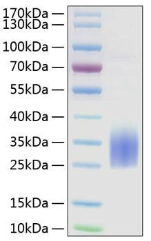 Recombinant Human TREM2 Protein (RPCB0872)