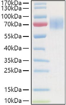 Recombinant Human Guanylyl cyclase C/GUCY2C Protein (RPCB0918)