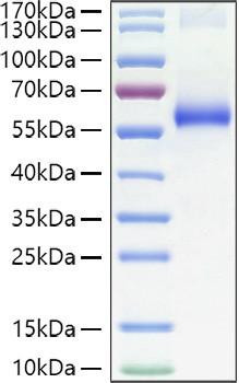 Recombinant Human TNFRSF1A/TNF-R1/CD120a Protein (RPCB0927)