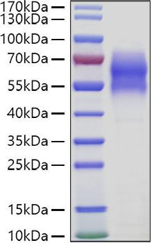 Recombinant Human WAIF1/5T4/TPBG Protein (RPCB0930)