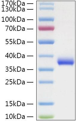 Recombinant SARS-COV-2 Spike RBD(N501Y)  Protein (RPCB0955)