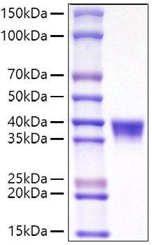 Recombinant Mouse CD38 Protein (RPCB0969)