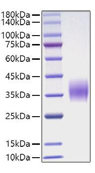 Recombinant Mouse Oncostatin-M/OSM Protein (RPCB1026)
